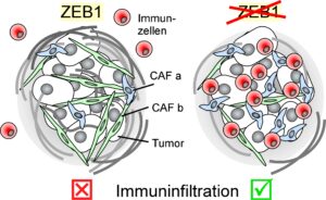 Sketch of an immune infiltration: In the mouse model, immune cells (red) can penetrate the colorectal tumor if ZEB1 is switched off in CAFs (green, blue), thereby increasing the effectiveness of immunotherapy. (image: FAU/GSH)