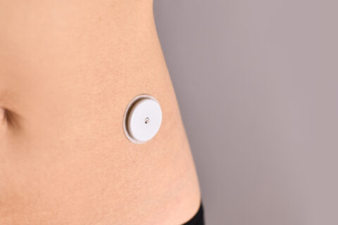 Glucose Sensor angebracht am Bauch einer Person